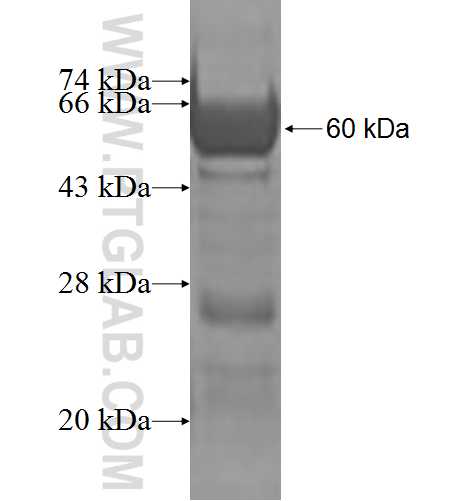 ANKRD2 fusion protein Ag2389 SDS-PAGE