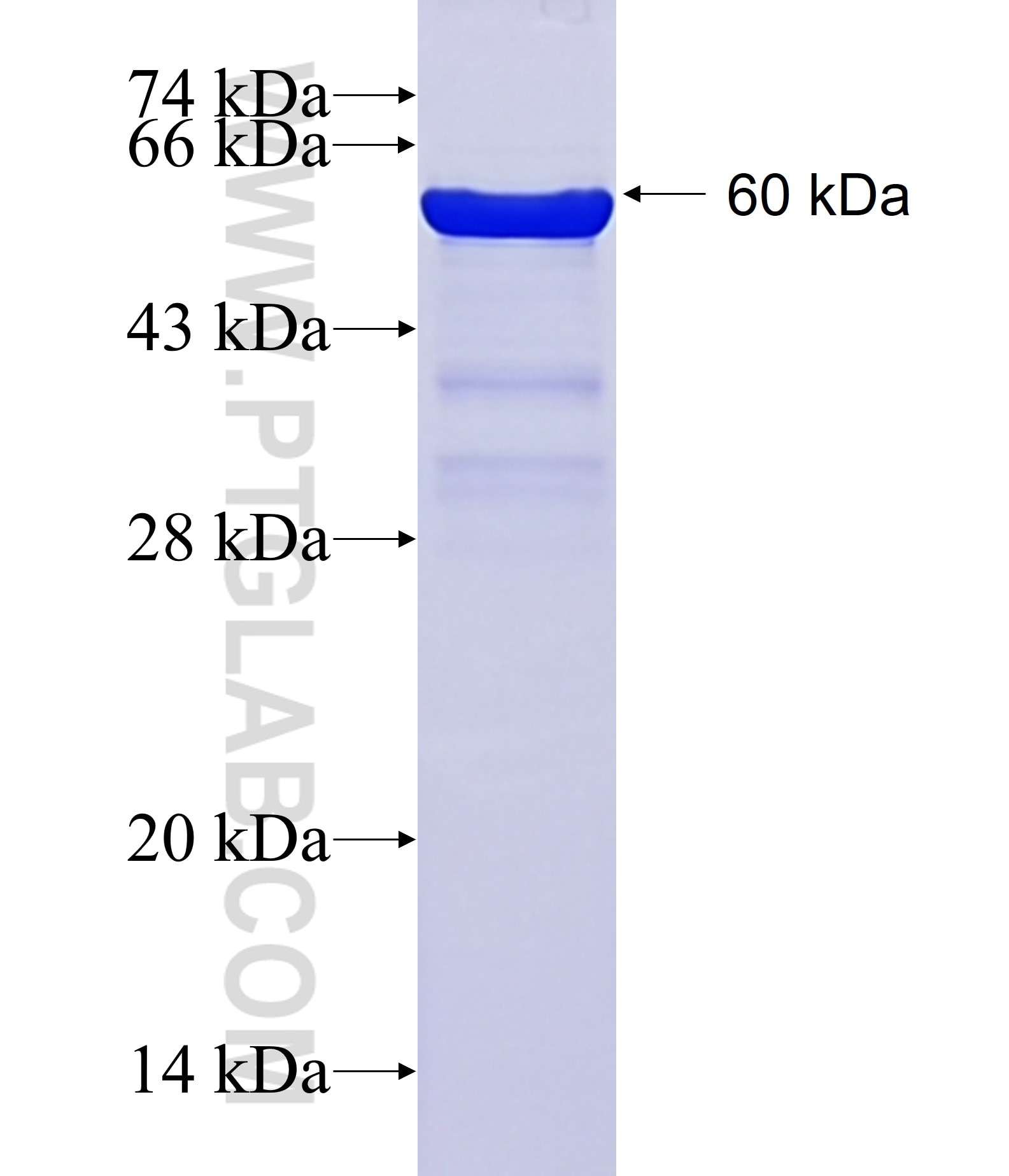 ANKRD2 fusion protein Ag2389 SDS-PAGE