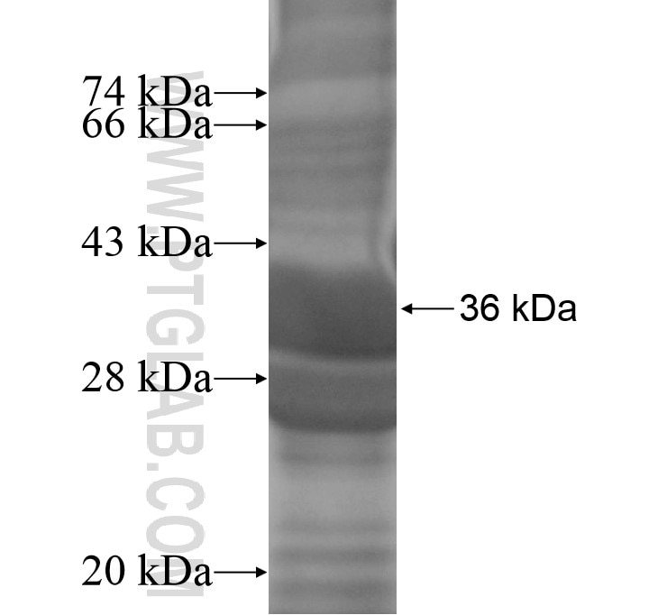 ANKRD20A5 fusion protein Ag14262 SDS-PAGE