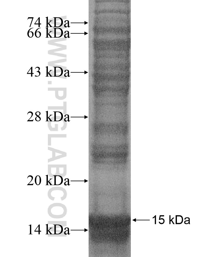 ANKRD20A5 fusion protein Ag16954 SDS-PAGE