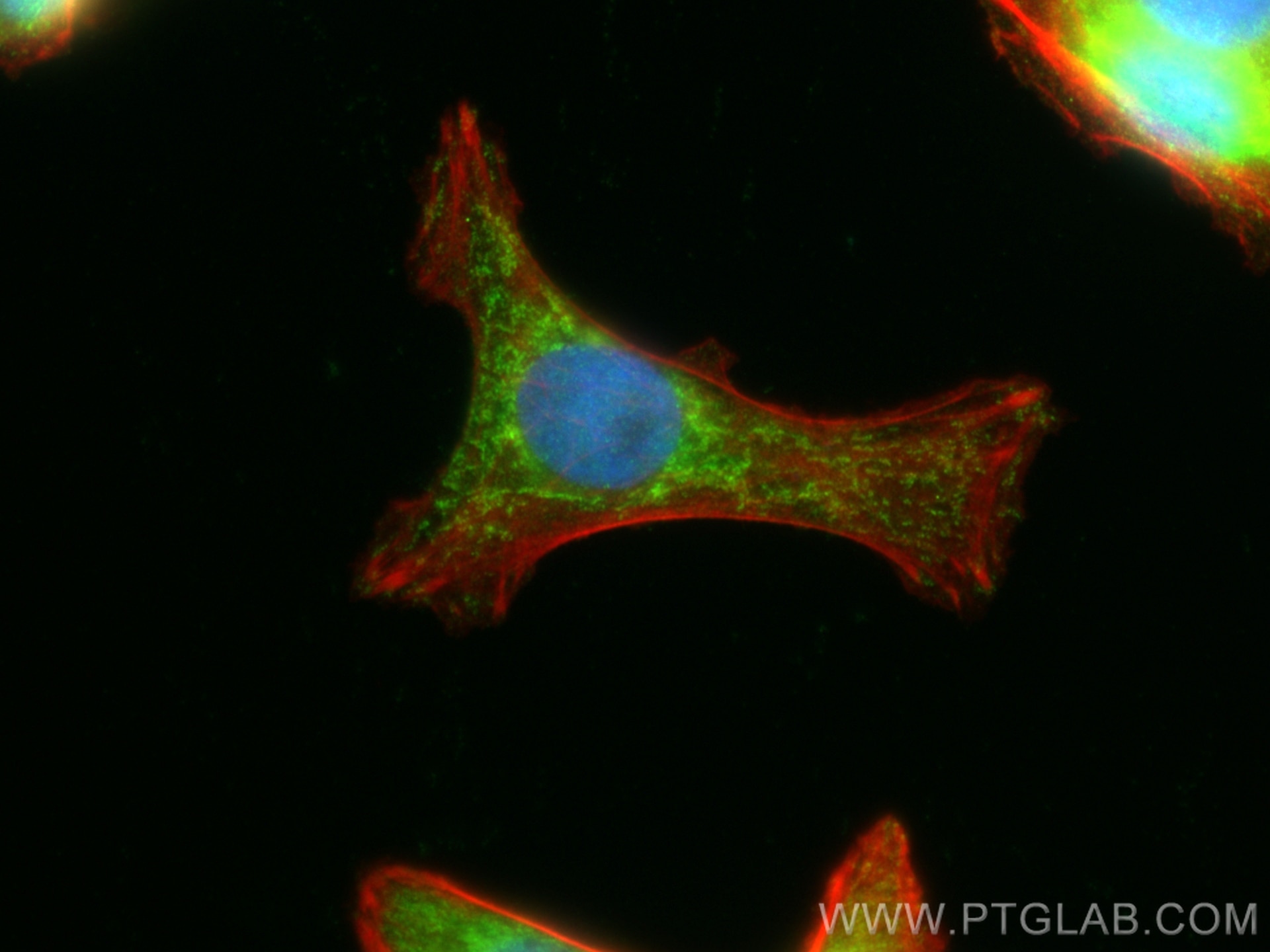 Immunofluorescence (IF) / fluorescent staining of SW480 cells using ANKRD22 Polyclonal antibody (24035-1-AP)
