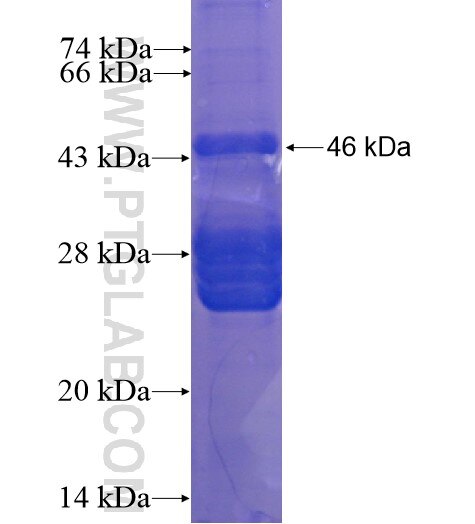 ANKRD23 fusion protein Ag15720 SDS-PAGE