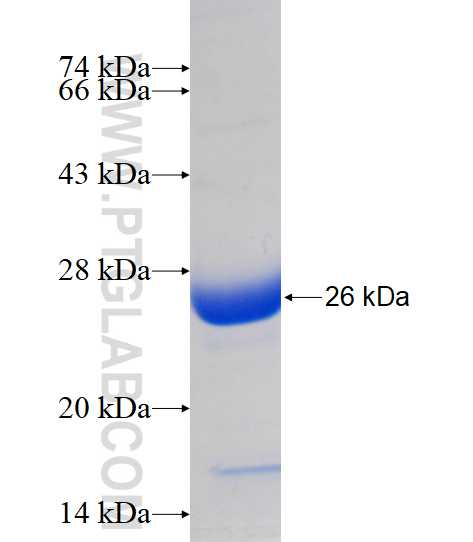 ANKRD23 fusion protein Ag17194 SDS-PAGE