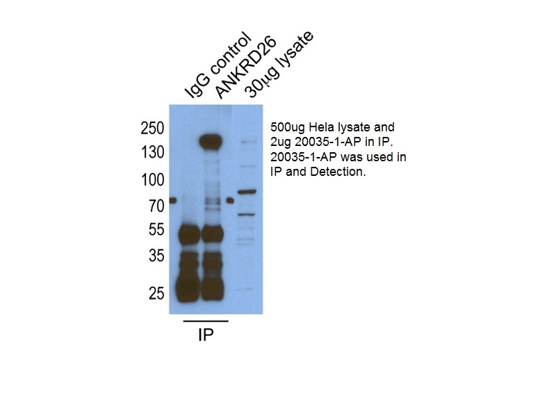 Immunoprecipitation (IP) experiment of HeLa cells using ANKRD26 Polyclonal antibody (20035-1-AP)