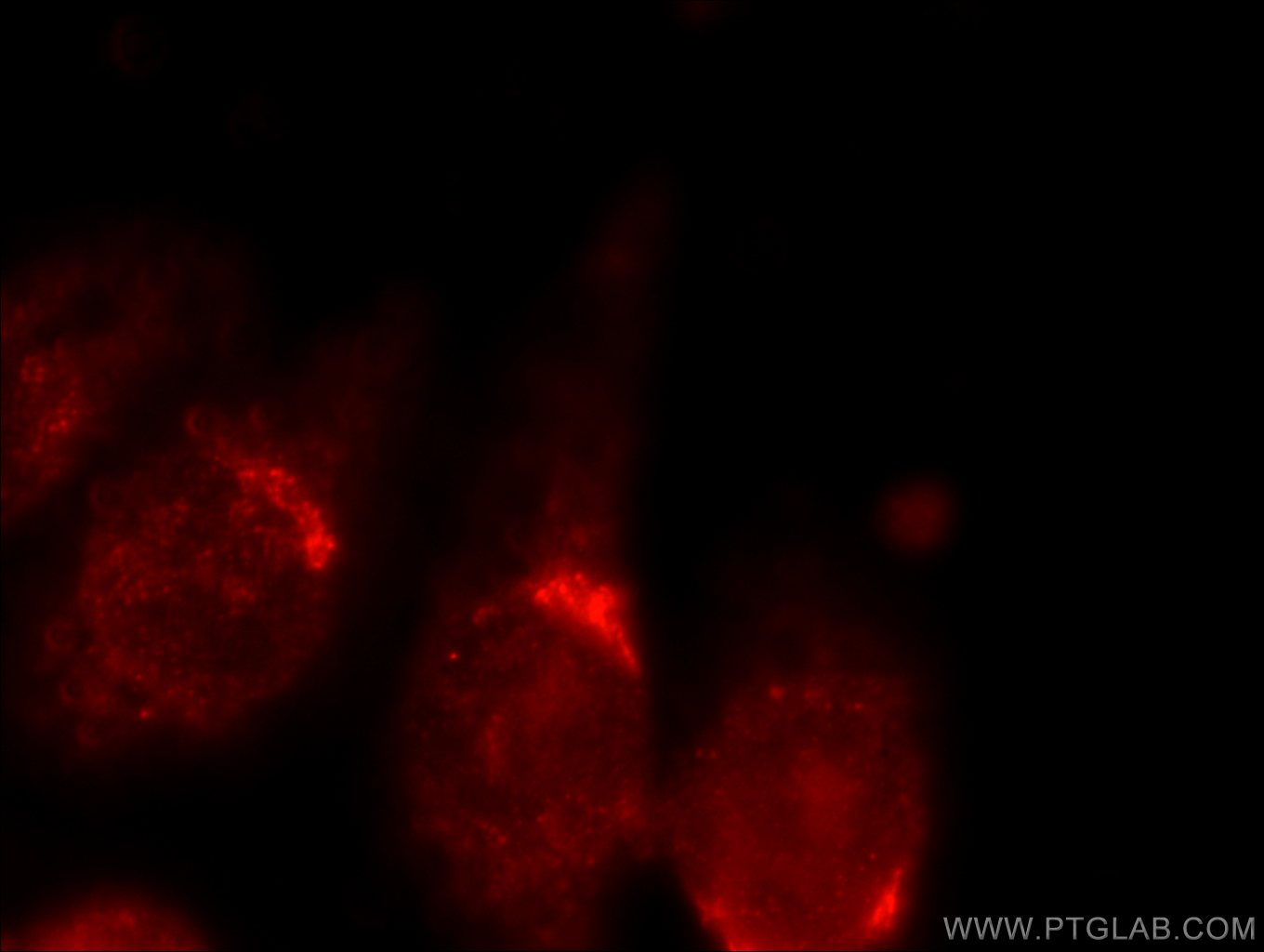 Immunofluorescence (IF) / fluorescent staining of HeLa cells using ANKRD26 Polyclonal antibody (20035-1-AP)