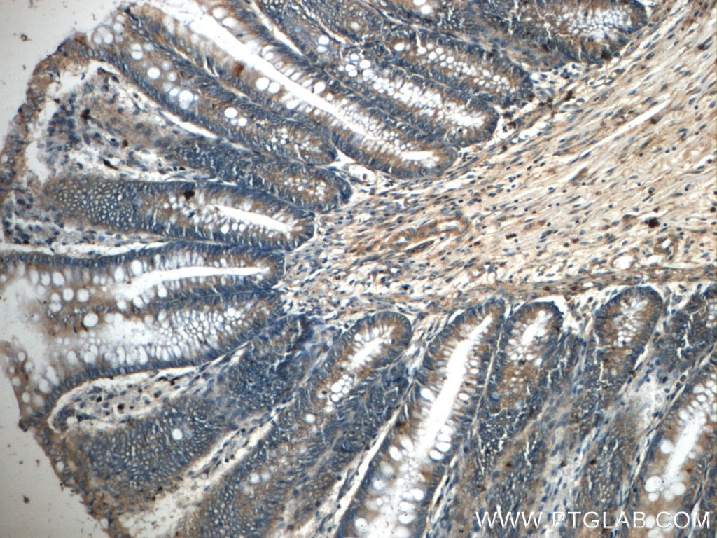 IHC staining of human colon using 20035-1-AP