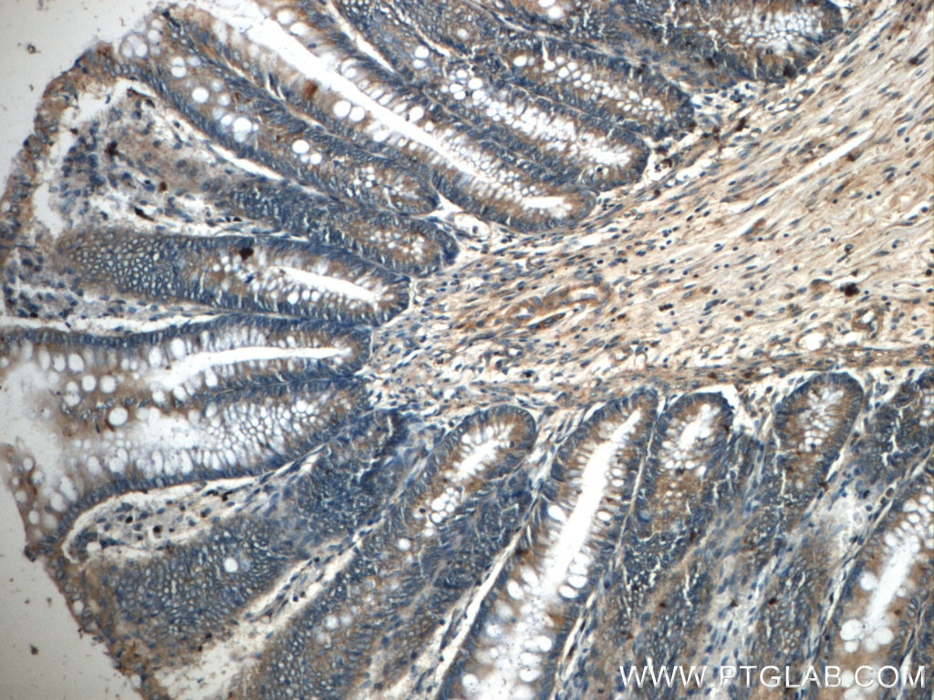 Immunohistochemistry (IHC) staining of human colon tissue using ANKRD26 Polyclonal antibody (20035-1-AP)