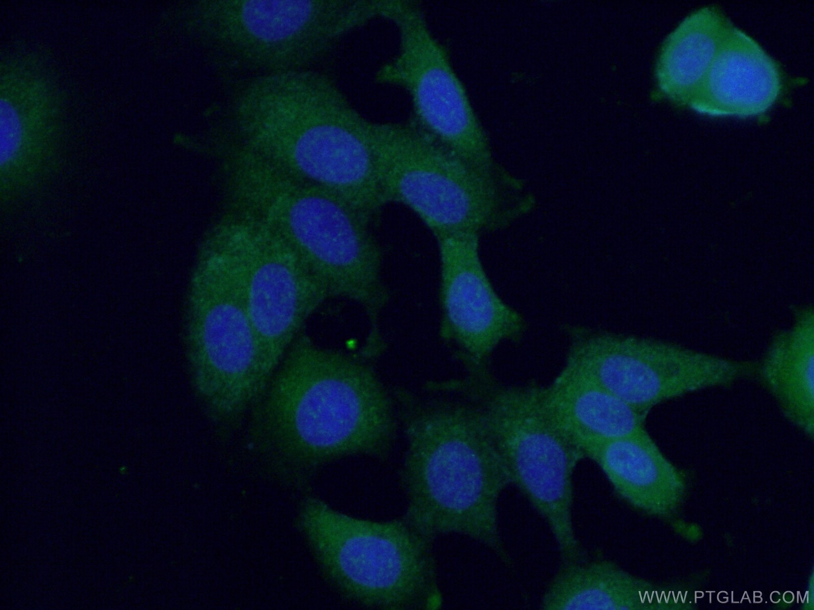 Immunofluorescence (IF) / fluorescent staining of MCF-7 cells using ANKRD27 Polyclonal antibody (24034-1-AP)