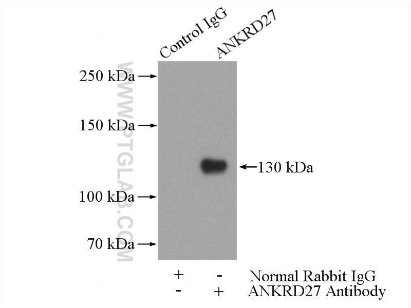 Immunoprecipitation (IP) experiment of A431 cells using ANKRD27 Polyclonal antibody (24034-1-AP)