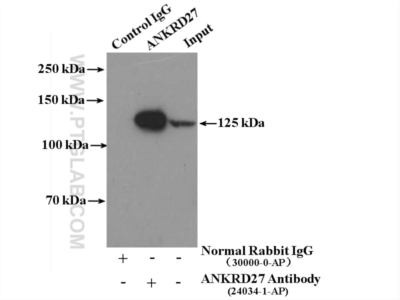 Immunoprecipitation (IP) experiment of MCF-7 cells using ANKRD27 Polyclonal antibody (24034-1-AP)