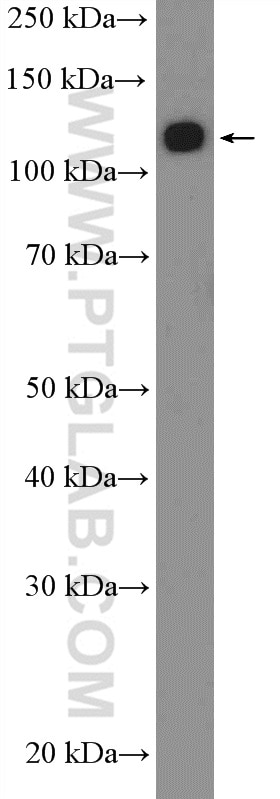 Western Blot (WB) analysis of MCF-7 cells using ANKRD27 Polyclonal antibody (24034-1-AP)