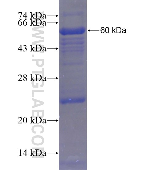 ANKRD27 fusion protein Ag21239 SDS-PAGE