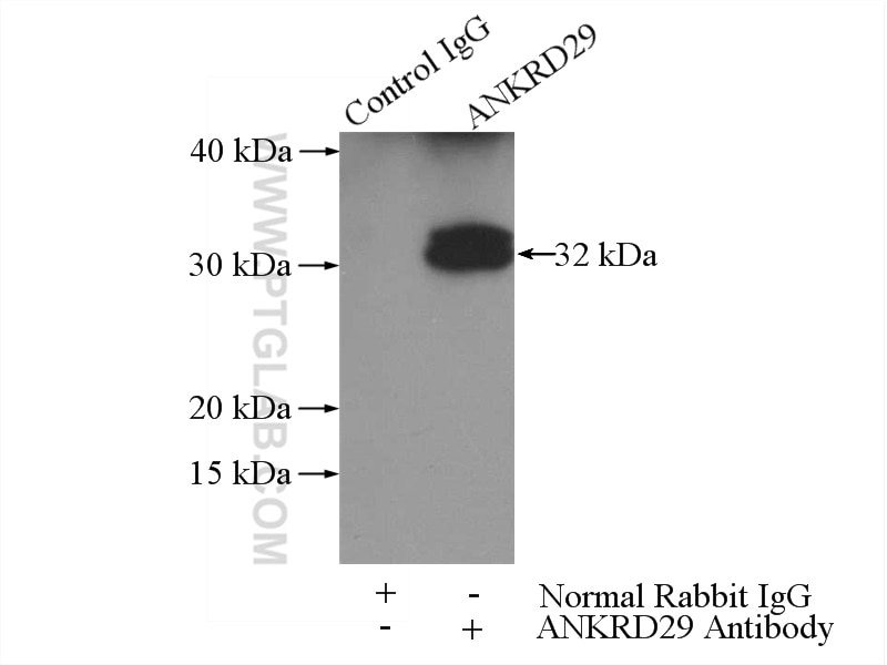 Immunoprecipitation (IP) experiment of mouse brain tissue using ANKRD29 Polyclonal antibody (23999-1-AP)
