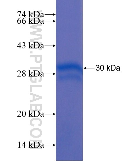 ANKRD29 fusion protein Ag21201 SDS-PAGE