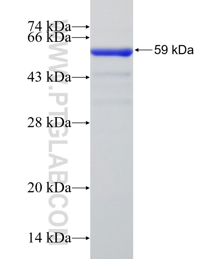ANKRD31 fusion protein Ag31858 SDS-PAGE