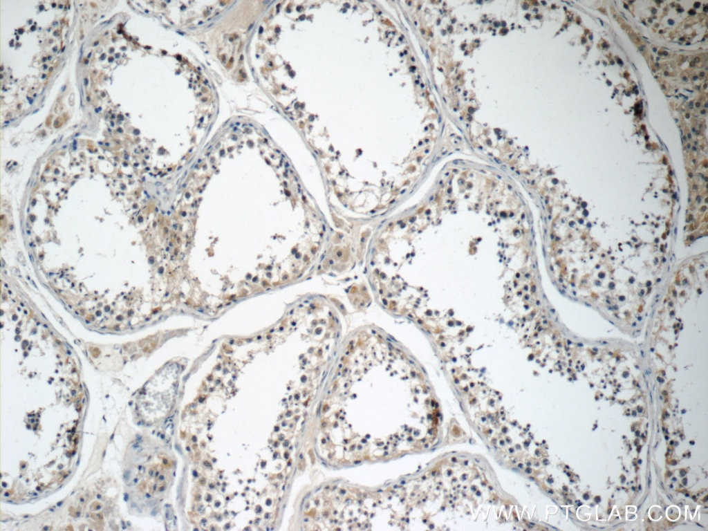 Immunohistochemistry (IHC) staining of human testis tissue using ANKRD33 Polyclonal antibody (25202-1-AP)