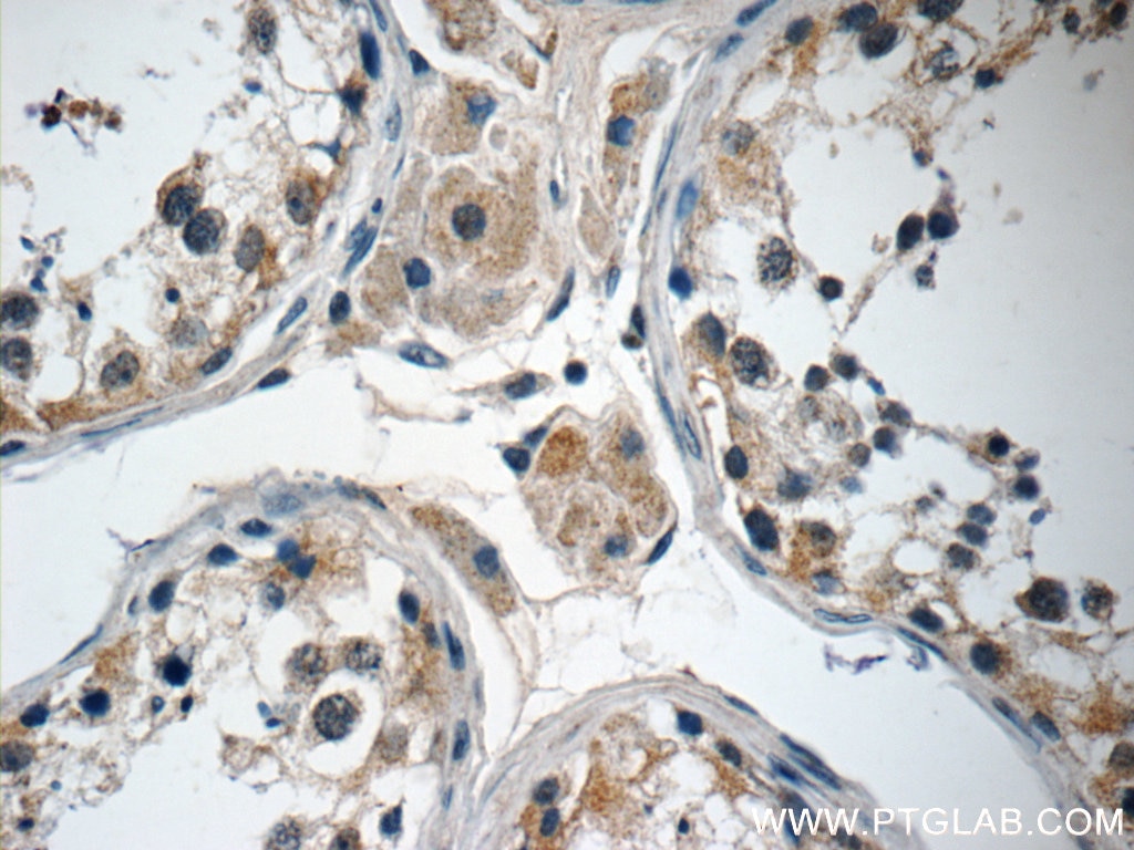 IHC staining of human testis using 25202-1-AP