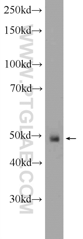 Western Blot (WB) analysis of Y79 cells using ANKRD33 Polyclonal antibody (25202-1-AP)