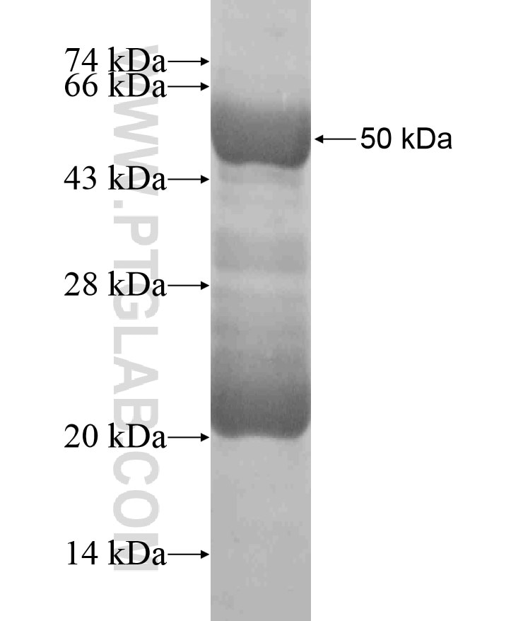 ANKRD33 fusion protein Ag18582 SDS-PAGE