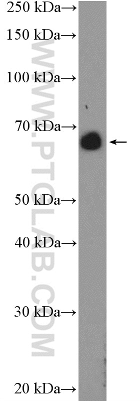 Western Blot (WB) analysis of mouse thymus tissue using ANKRD34B Polyclonal antibody (24581-1-AP)