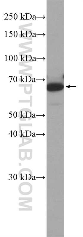 Western Blot (WB) analysis of mouse thymus tissue using ANKRD34B Polyclonal antibody (24581-1-AP)