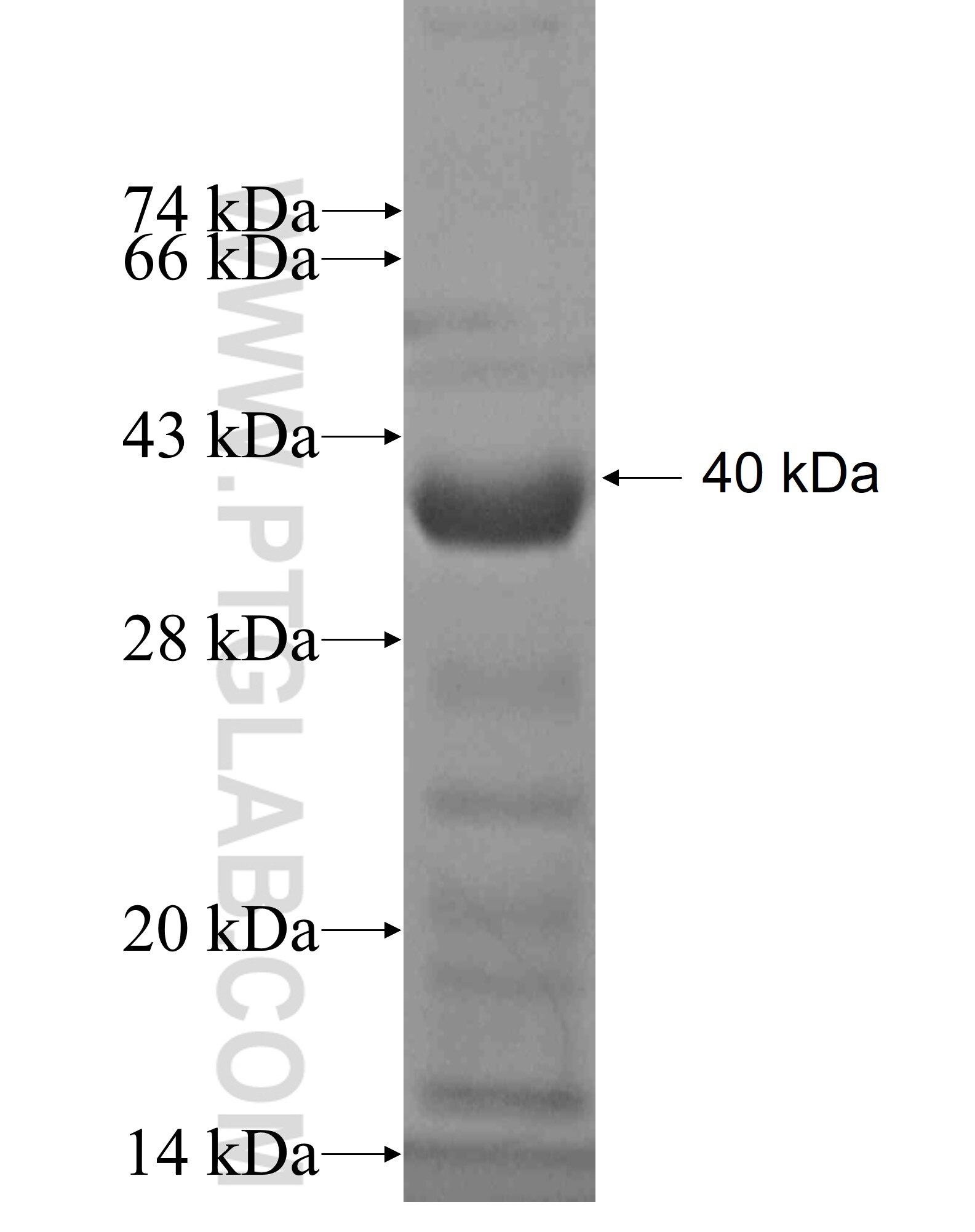 ANKRD34B fusion protein Ag20346 SDS-PAGE