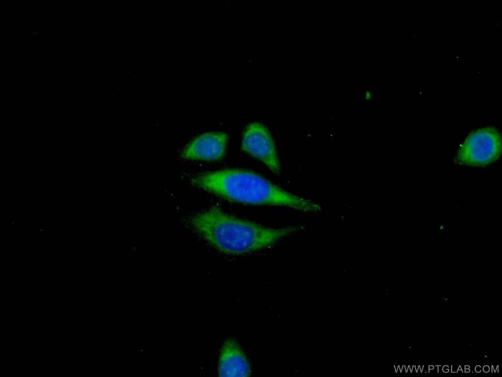 Immunofluorescence (IF) / fluorescent staining of PC-3 cells using ANKRD39 Polyclonal antibody (24027-1-AP)