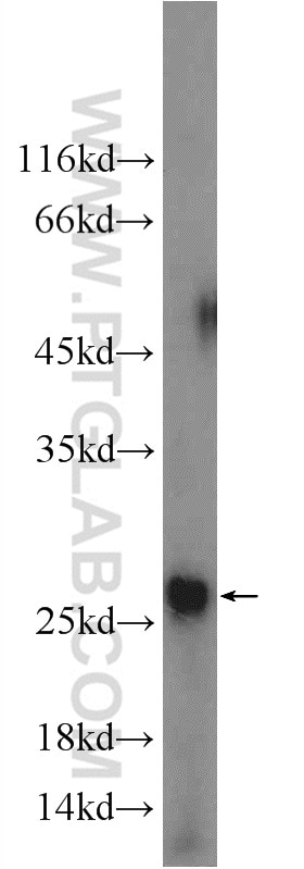 Western Blot (WB) analysis of PC-3 cells using ANKRD39 Polyclonal antibody (24027-1-AP)