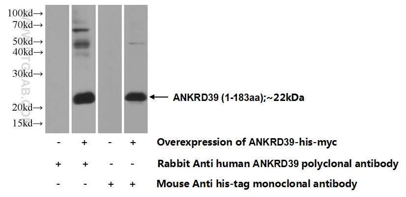 Western Blot (WB) analysis of Transfected HEK-293 cells using ANKRD39 Polyclonal antibody (24027-1-AP)