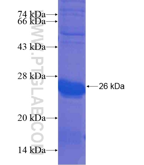 ANKRD39 fusion protein Ag21210 SDS-PAGE