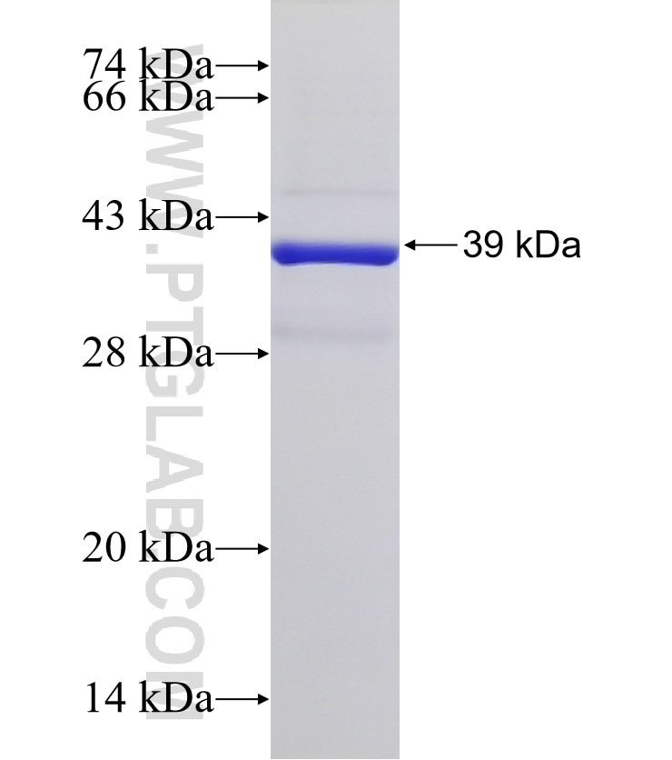 ANKRD42 fusion protein Ag32829 SDS-PAGE ANKRD42 fusion protein Ag32829 SDS-PAGE