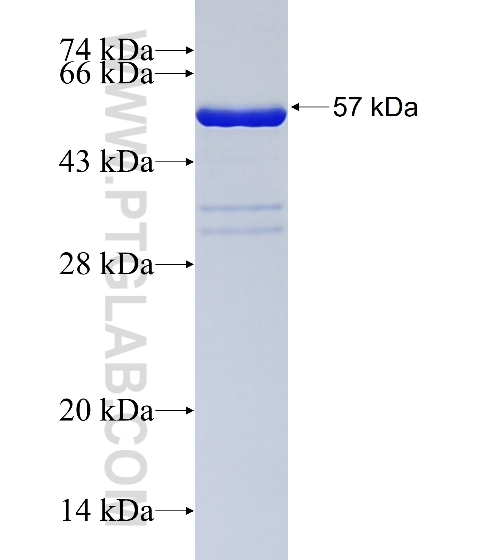 ANKRD45 fusion protein Ag38065 SDS-PAGE ANKRD45 fusion protein Ag38065 SDS-PAGE