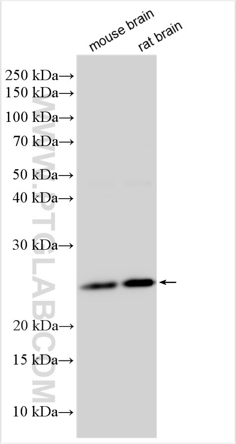 Western Blot (WB) analysis of various lysates using ANKRD46 Polyclonal antibody (27568-1-AP)