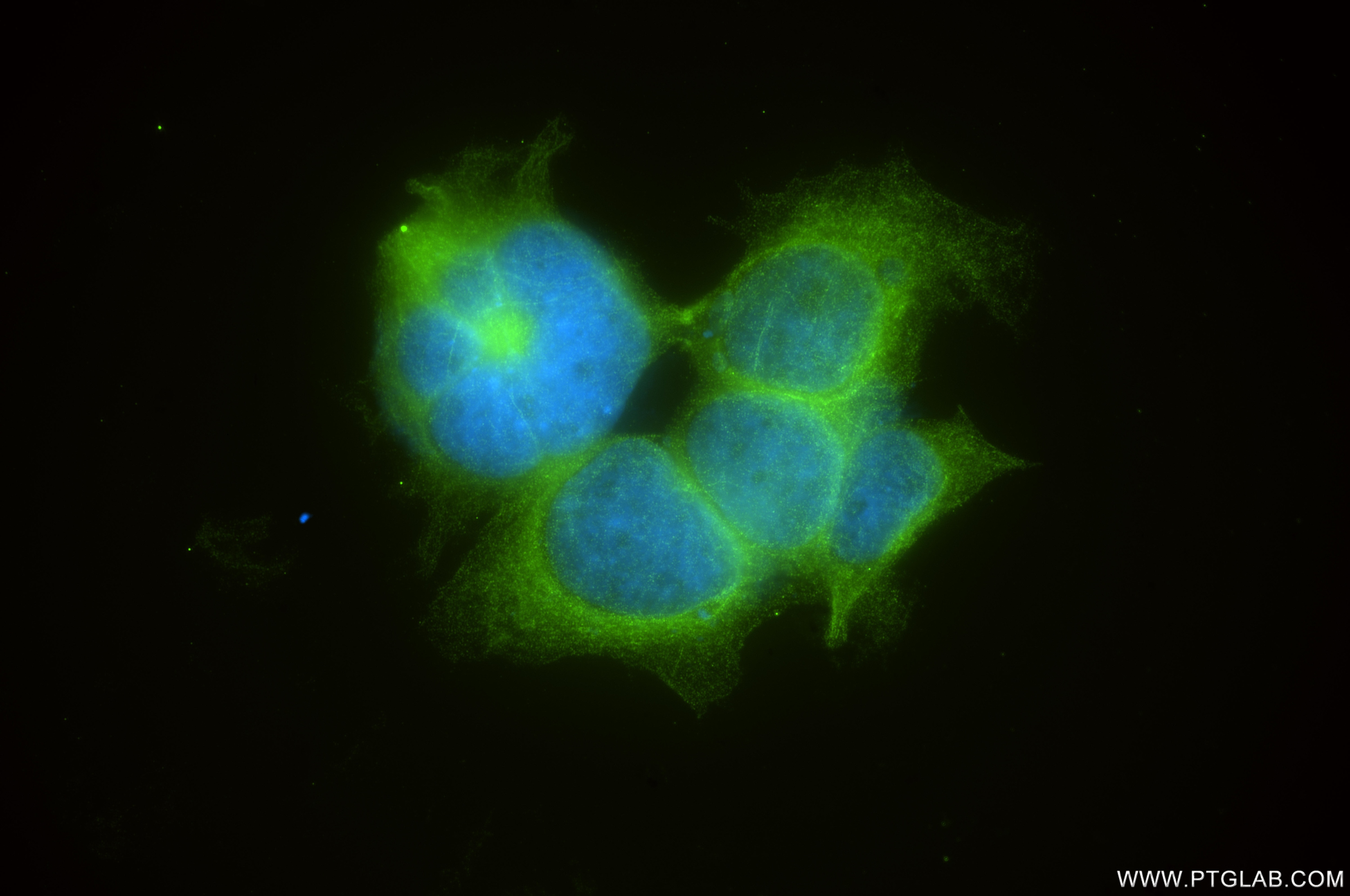 Immunofluorescence (IF) / fluorescent staining of HEK-293 cells using ANKRD46 Recombinant monoclonal antibody (86827-4-RR)