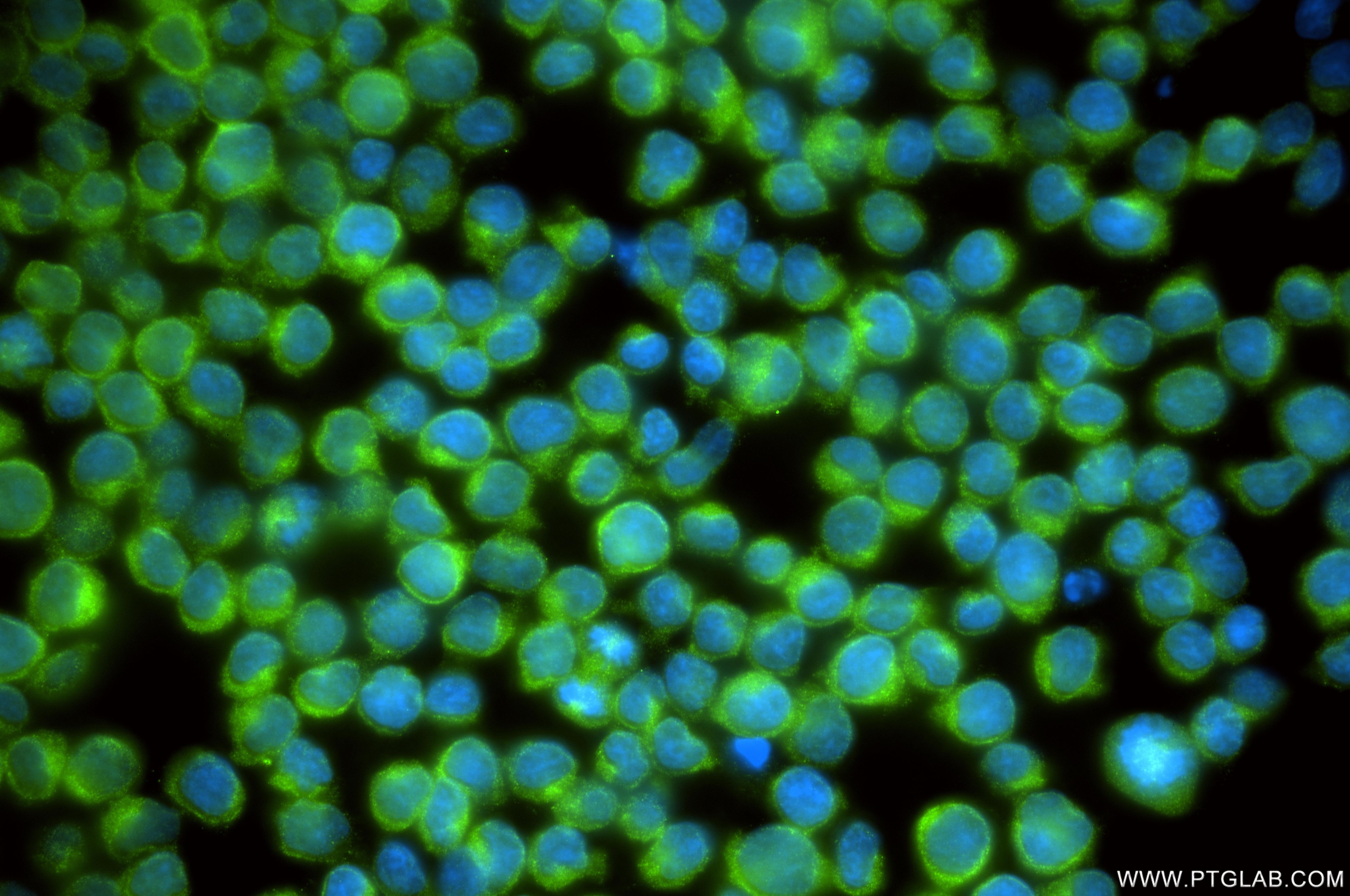 Immunofluorescence (IF) / fluorescent staining of Jurkat cells using ANKRD46 Recombinant monoclonal antibody (86827-4-RR)