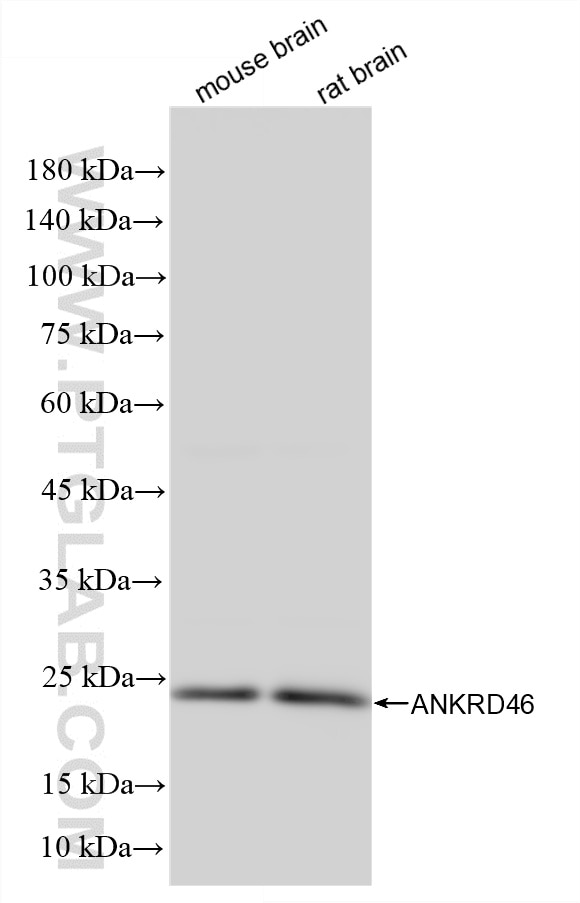 Western Blot (WB) analysis of various lysates using ANKRD46 Recombinant monoclonal antibody (86827-4-RR)