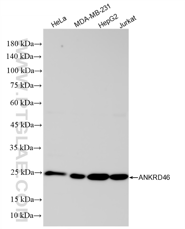 Western Blot (WB) analysis of various lysates using ANKRD46 Recombinant monoclonal antibody (86827-4-RR)