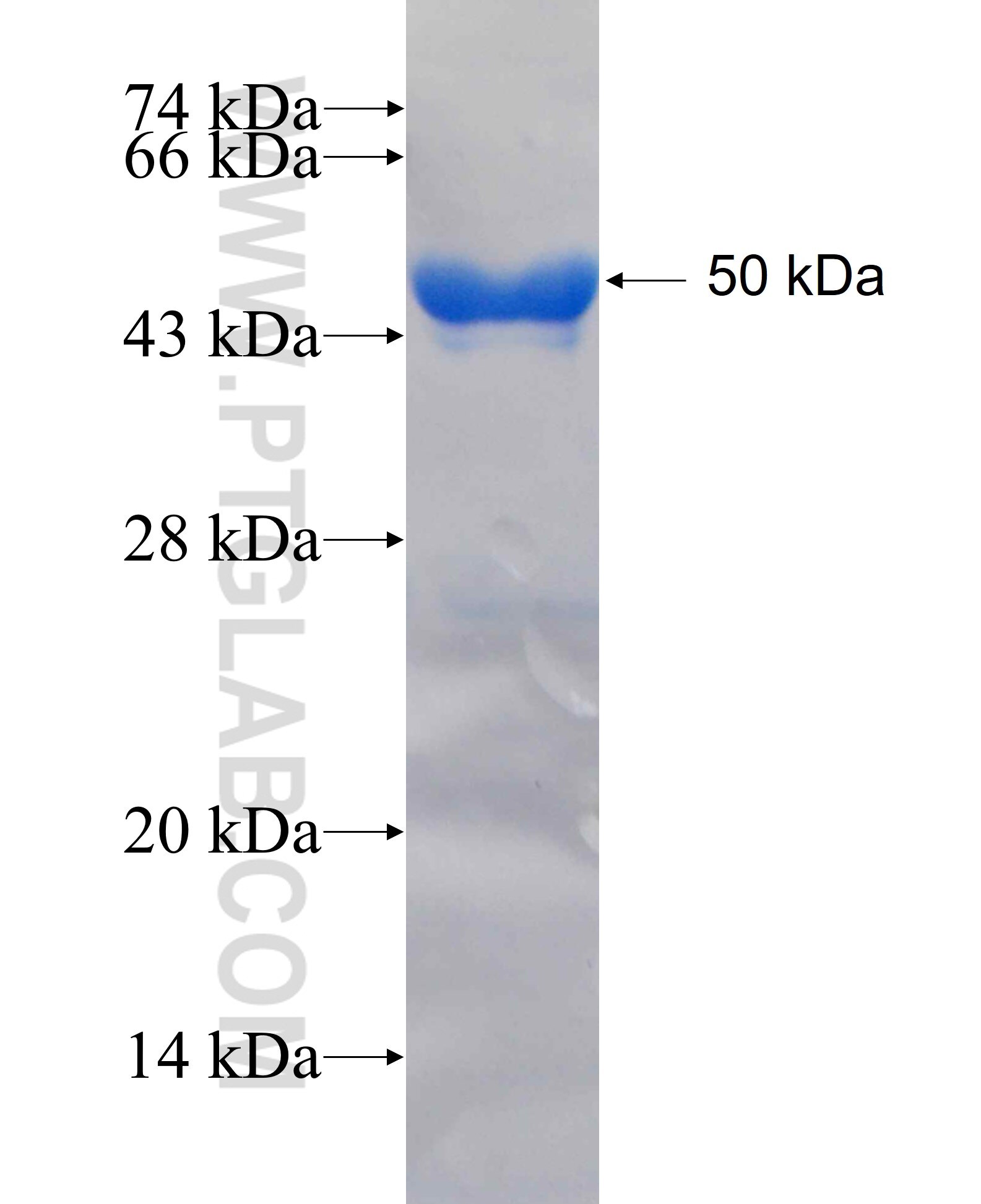 ANKRD46 fusion protein Ag26623 SDS-PAGE