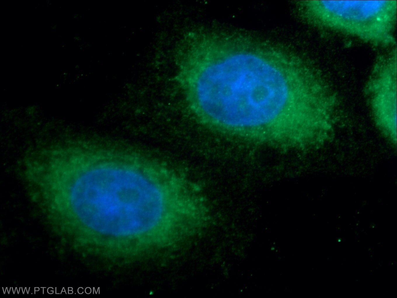 Immunofluorescence (IF) / fluorescent staining of HepG2 cells using ANKRD49 Polyclonal antibody (25034-1-AP)