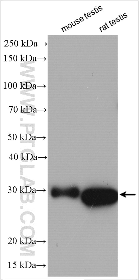 Western Blot (WB) analysis of various lysates using ANKRD49 Polyclonal antibody (25034-1-AP)