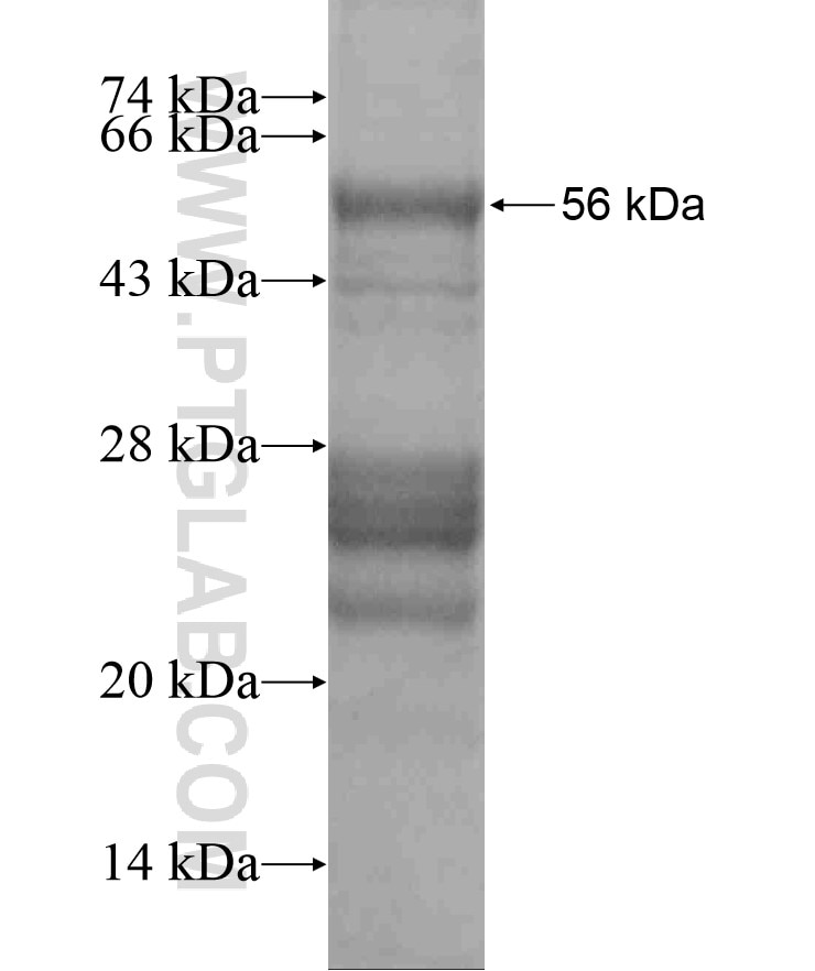ANKRD49 fusion protein Ag18295 SDS-PAGE