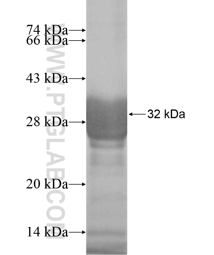 ANKRD49 fusion protein Ag18338 SDS-PAGE