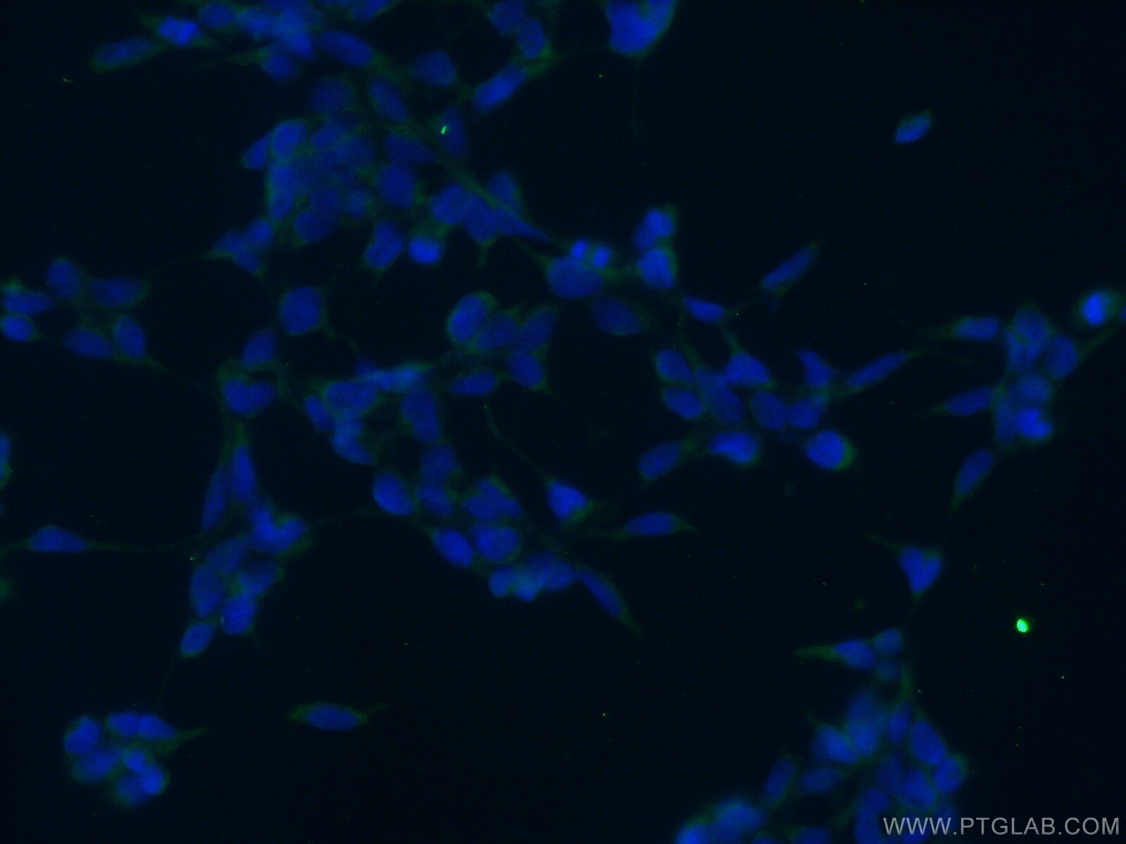 Immunofluorescence (IF) / fluorescent staining of HEK-293 cells using ANKRD50 Polyclonal antibody (24032-1-AP)