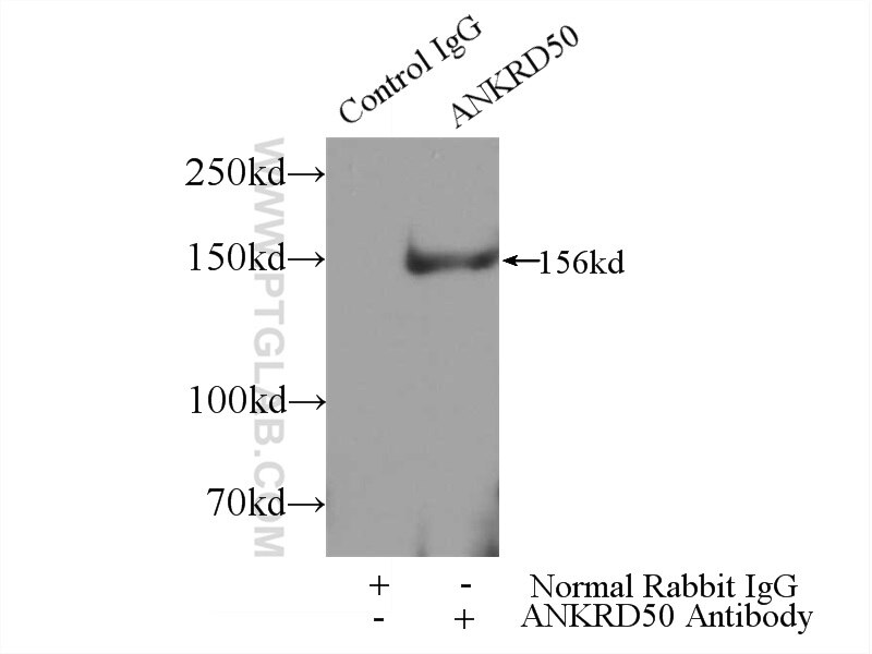 Immunoprecipitation (IP) experiment of HEK-293 cells using ANKRD50 Polyclonal antibody (24032-1-AP)