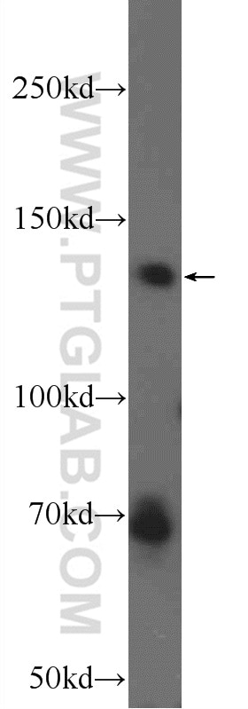 Western Blot (WB) analysis of HEK-293 cells using ANKRD50 Polyclonal antibody (24032-1-AP)