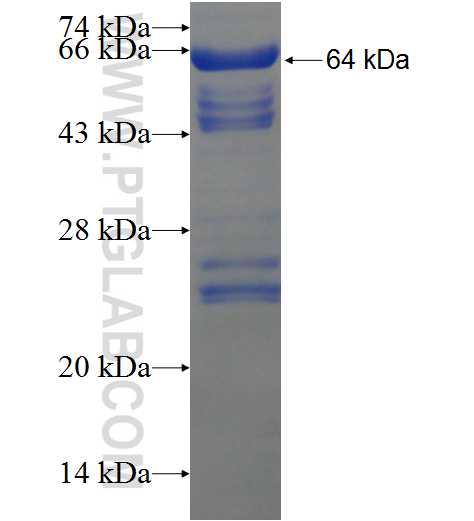 ANKRD50 fusion protein Ag21237 SDS-PAGE