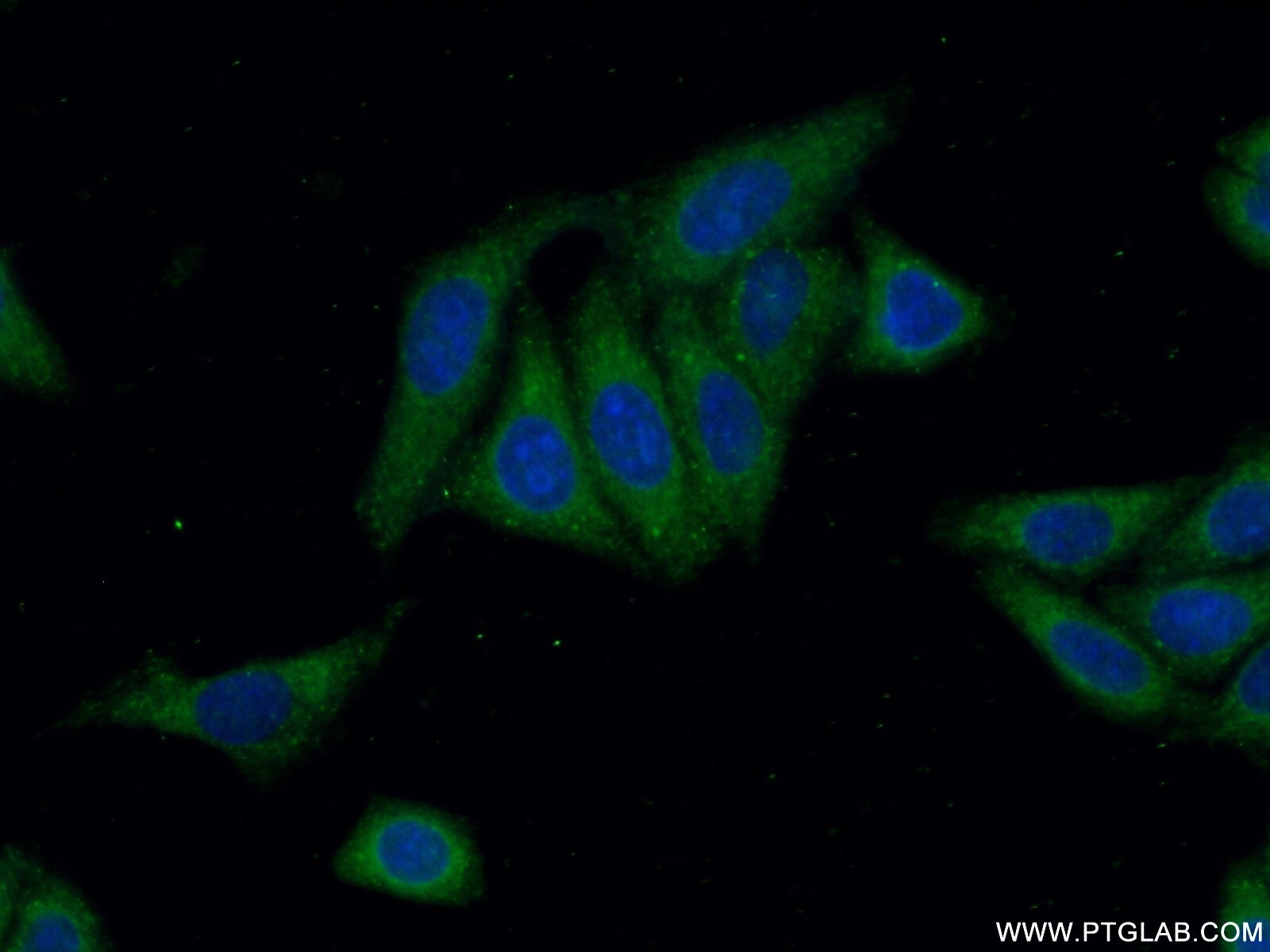 Immunofluorescence (IF) / fluorescent staining of HepG2 cells using ANKRD53 Polyclonal antibody (24283-1-AP)