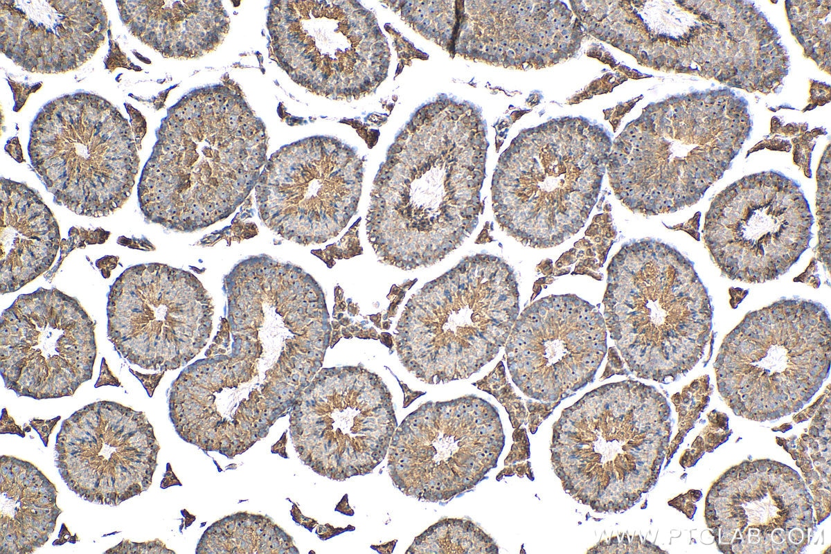 IHC staining of mouse testis using 24283-1-AP