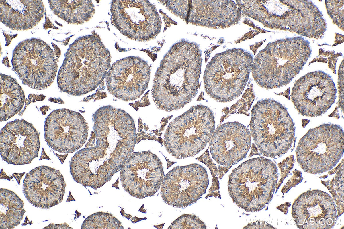 Immunohistochemistry (IHC) staining of mouse testis tissue using ANKRD53 Polyclonal antibody (24283-1-AP)