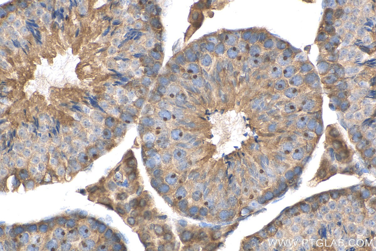 Immunohistochemistry (IHC) staining of mouse testis tissue using ANKRD53 Polyclonal antibody (24283-1-AP)